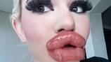 La “Barbie de la vida real” muestra su impactante cambio de labios