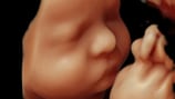 Ecografía 7D: el estudio del bebe es ahora más preciso y más intuitivo gracias a  la Inteligencia Artificial