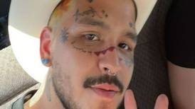 Los riesgos a la salud de Christian Nodal, luego de todos los tatuajes en su rostro