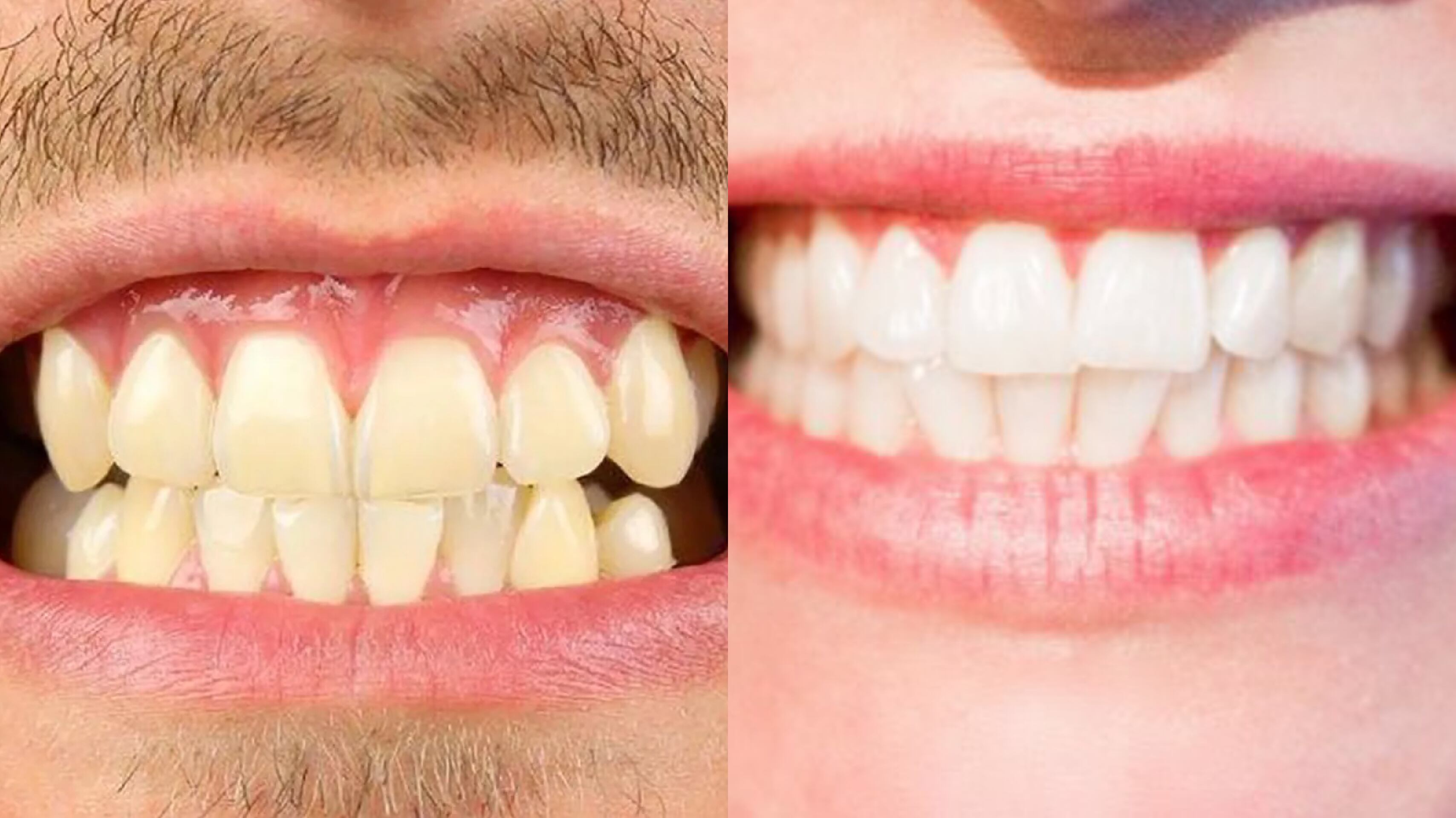 Dientes