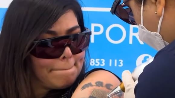 La actriz y modelo Angie Jibaja se está sometiendo a terapias para borrarse sus tatuajes.